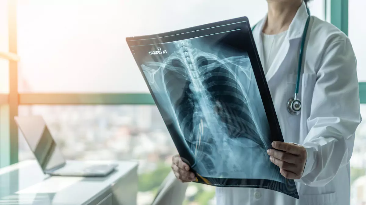 O que faz um Pneumologista? Veja as funções desse profissional. O que faz um Pneumologista? Veja as funções desse profissional.